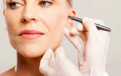 Avance en Belleza: Hilos Tensores PDO en la Vanguardia de la Estética