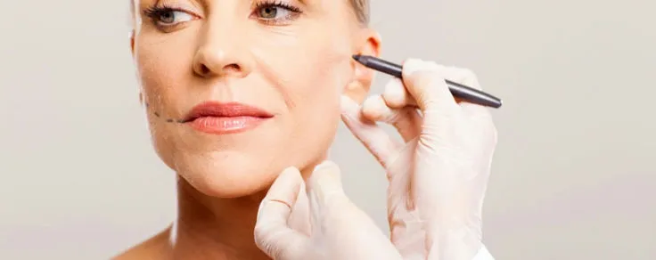 Avance en Belleza: Hilos Tensores PDO en la Vanguardia de la Estética