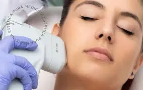 HIFU en Málaga: La Revolución en Rejuvenecimiento Facial y Corporal