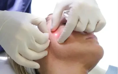 Innovación Transformadora: Endolifting, la Revolución en la Medicina Estética